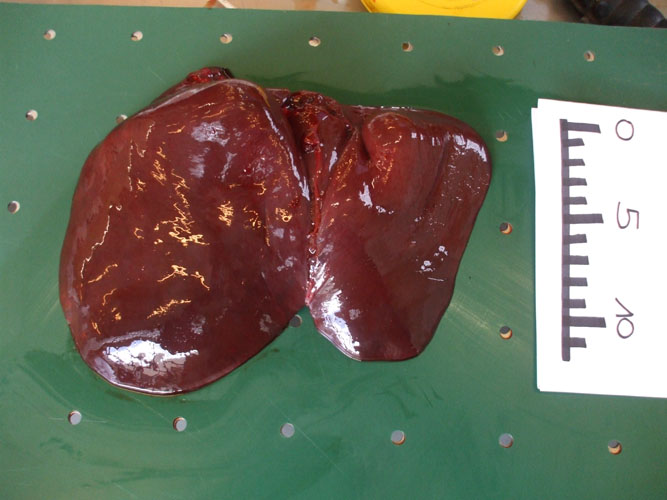 liver.jpg